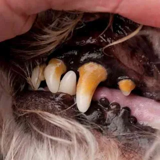 Dental Cleanings